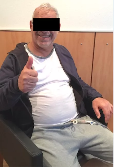 5毫升就可能致命的“脑干出血”到底有多可怕?能治得好吗?能手术吗? 5毫升就可能致命的“脑干出血”到底有多可怕?能治得好吗?能手术吗?